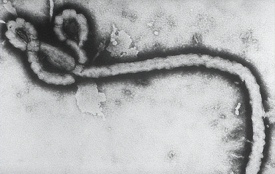 埃博拉病毒为什么突然消失（史上最强病毒埃博拉的来历） 6